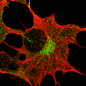 Preview: Antibody Labeling Kit